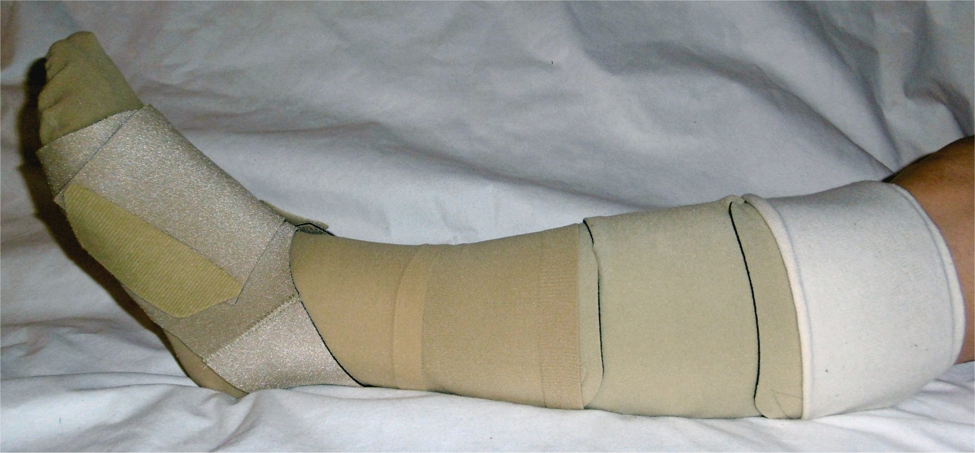 Klettbandage_mit_Fußteil